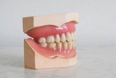 Damon Clear Braces | Fruge Orthodontics